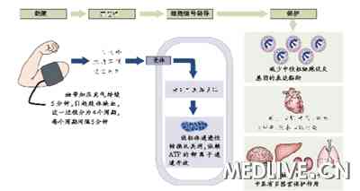 缺血预适应保护心肌能几何?