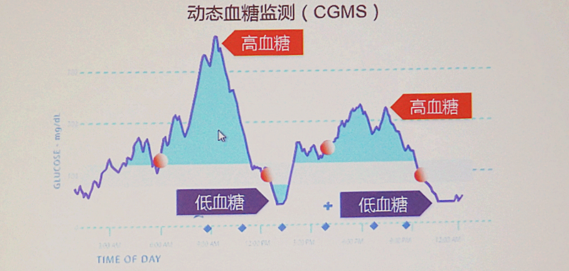 糖尿病患者一天血糖变化情况示意图