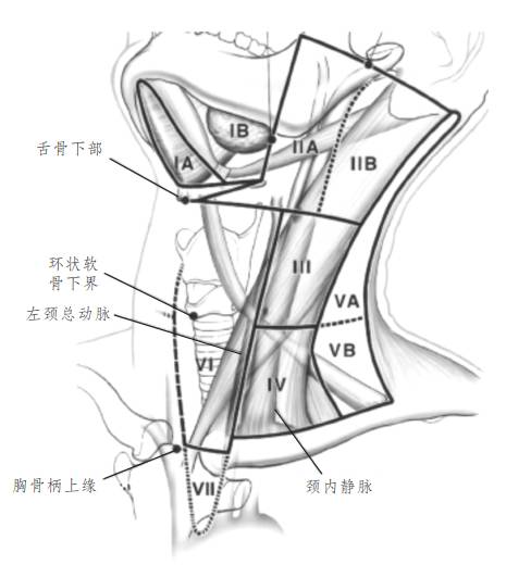 [有图有真相]颈部淋巴结的分区解析_头颈部鳞癌 _淋巴结病变_医脉通