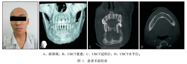 下颌肿胀疼痛是何原因