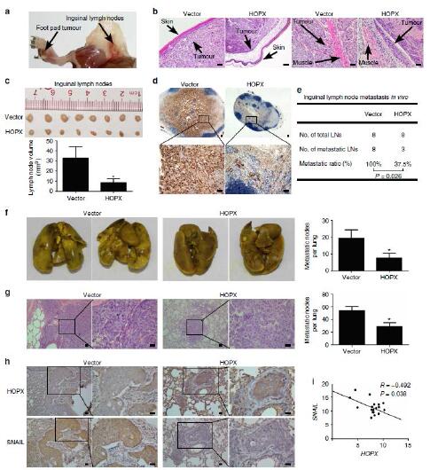 hopx增加鼻咽癌细胞对顺铂的敏感性在小鼠移植瘤模型内,hopx过表达