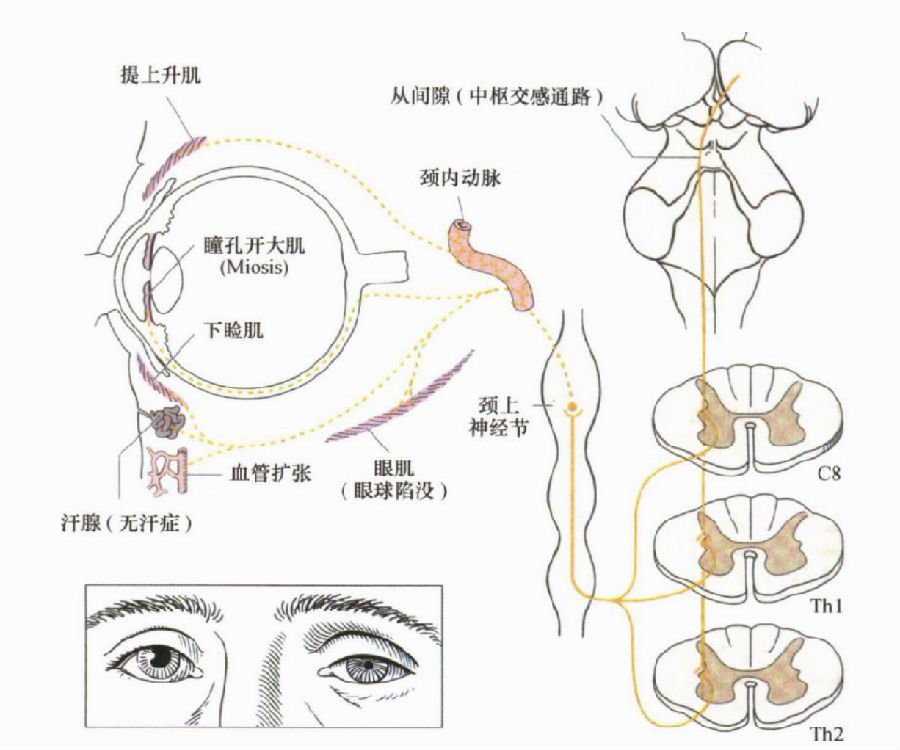 眼的副交感神经支配肌肉包括瞳孔括约肌和睫状肌,刺激副交感神经可