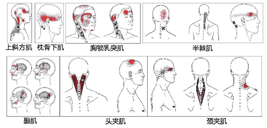 按摩"穴位"能治疗头痛吗?这个真的可以有!