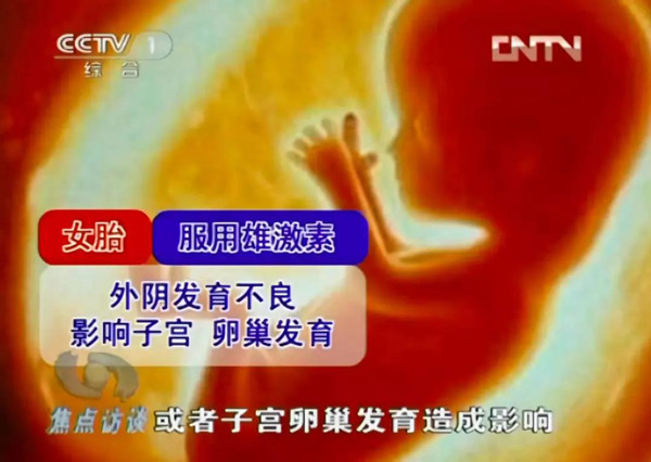 河南的一个孕妇在怀孕五个月时,吃下了婆婆拿来的转胎药.