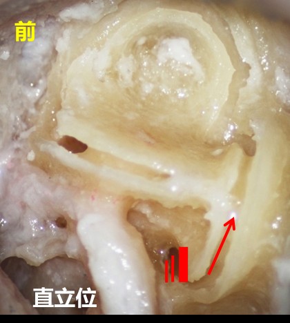 图文共赏后半规管bppv眼震再认识丨晕筹帷幄