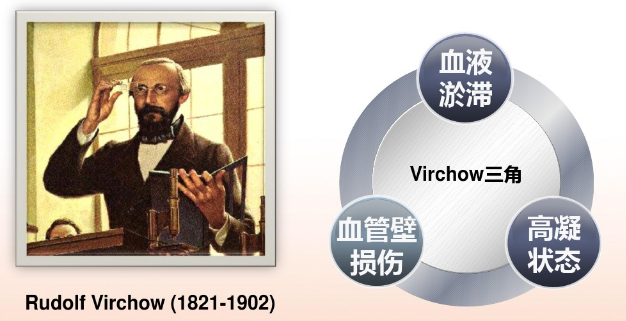 由德国病理学家鲁道夫·魏尔啸(rudolf virchow)提出的魏尔啸三联