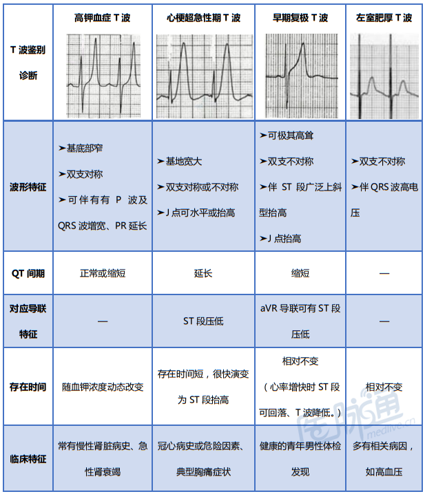 高钾血症心电图表现及鉴别诊断心电3分钟