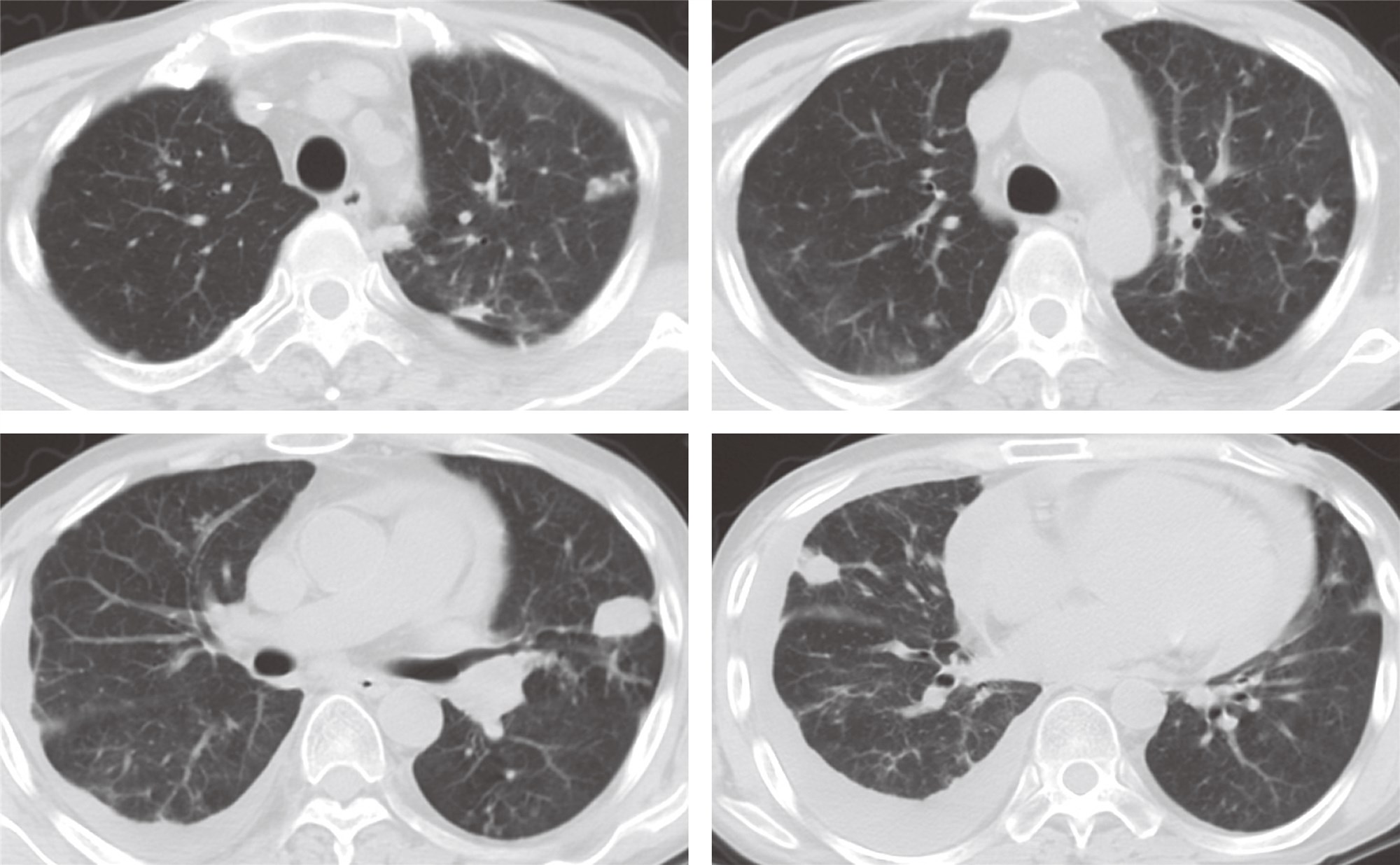 右肺中叶位置,肺中叶位置,右肺中叶位置图片_大山谷图库