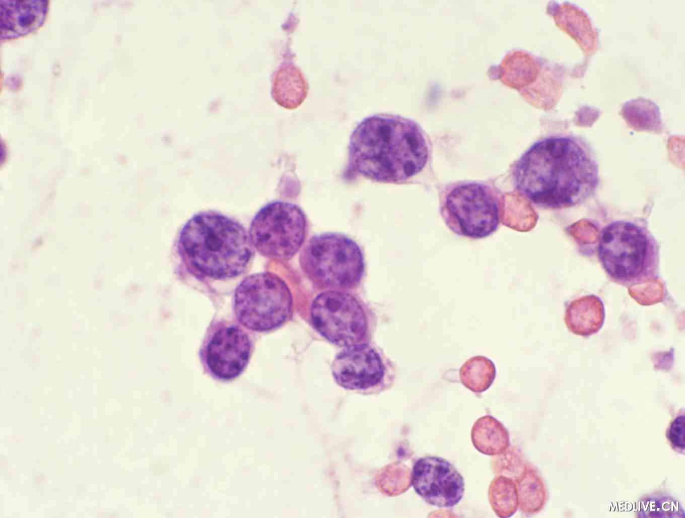 图3～28 血液中淋巴细胞(电镜照像)-基础医学-医学