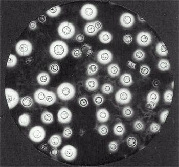 新型隐球菌革兰氏染色图片