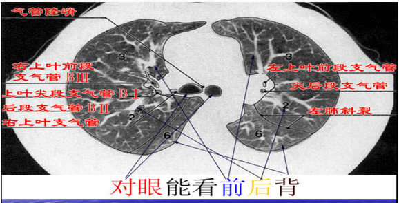 肺叶分段彩图图片
