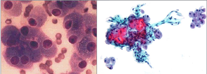 甲状腺c细胞图片