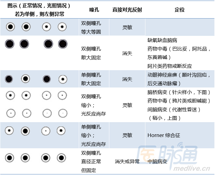 正常瞳孔大小正常值图片