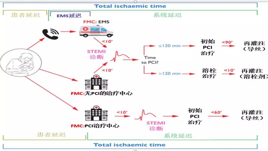 2017esc最新stemi指南口袋书中文版