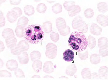 中性粒细胞淋巴细胞图片