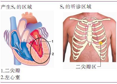 (2)心音特点s4的听诊位置为心尖部二尖瓣听诊区,偶尔,在这个位置也