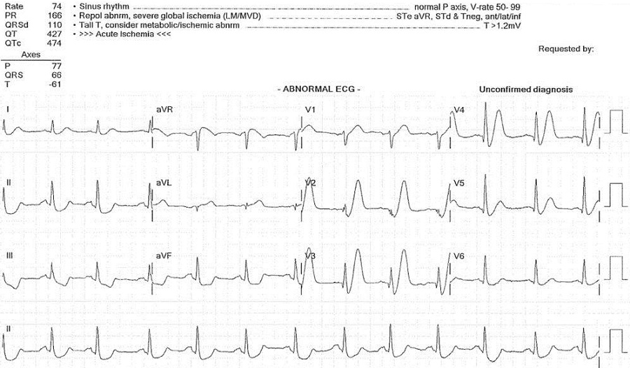 stemi305图片