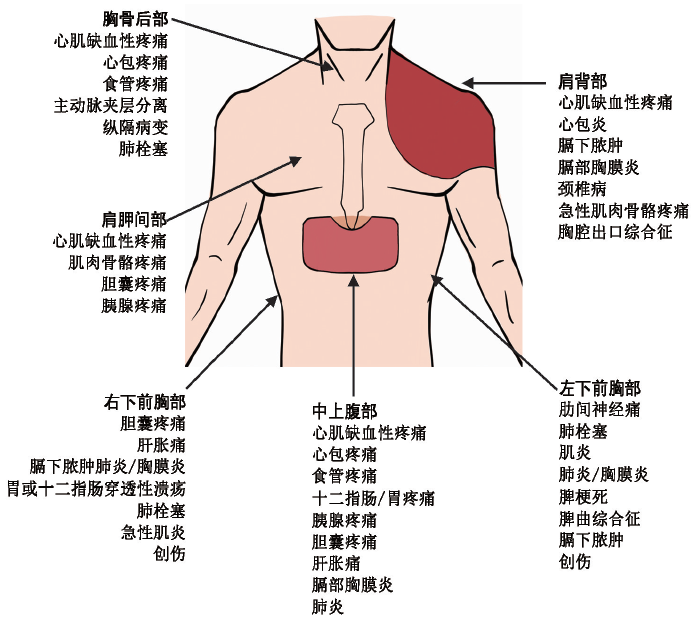 肺癌胸疼的位置图片图片