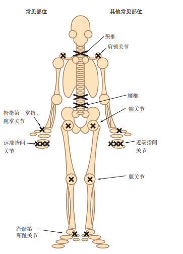 人体关节示意图简图图片