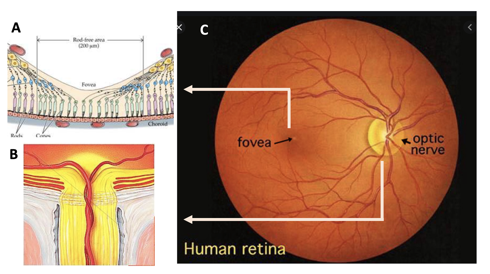 视网膜oct的详细图解图片