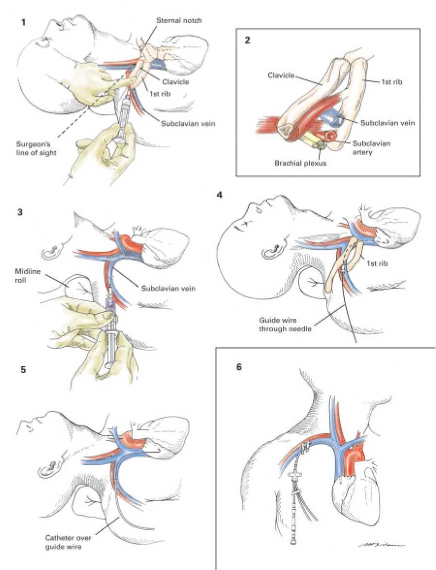 小鼠颈部血管解剖图图片