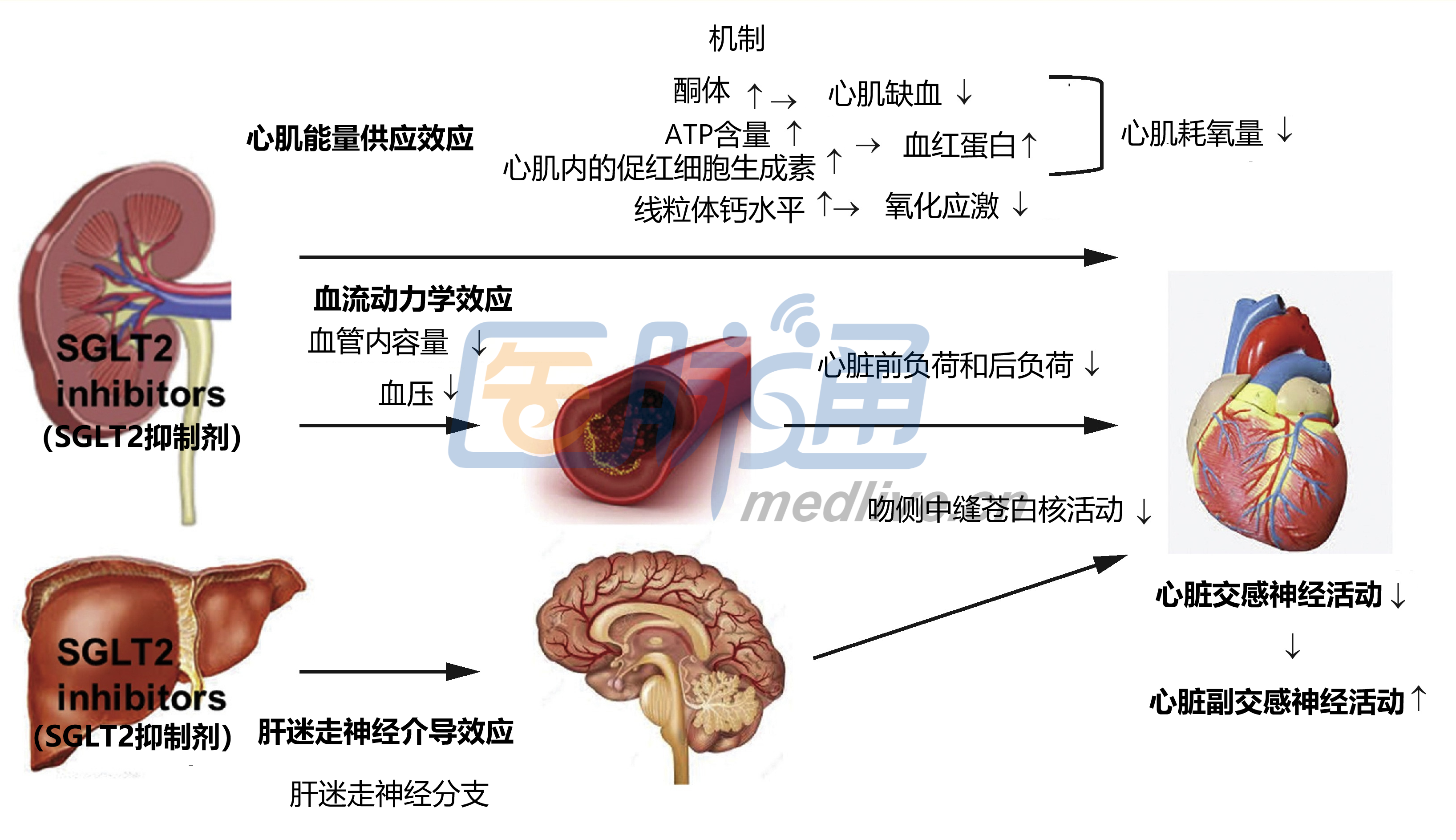 一文了解sglt2抑制剂的临床疗效及其心血管作用机制